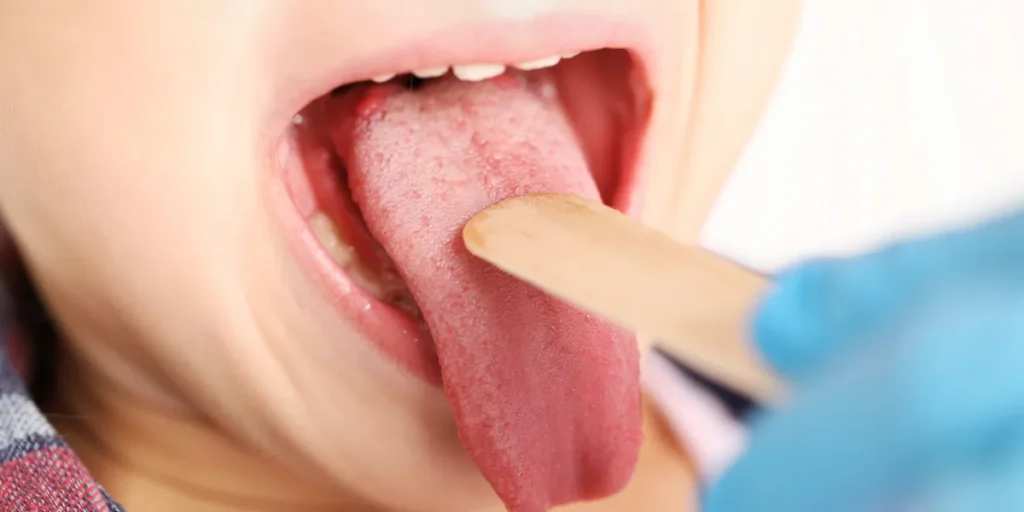 tongue chart health